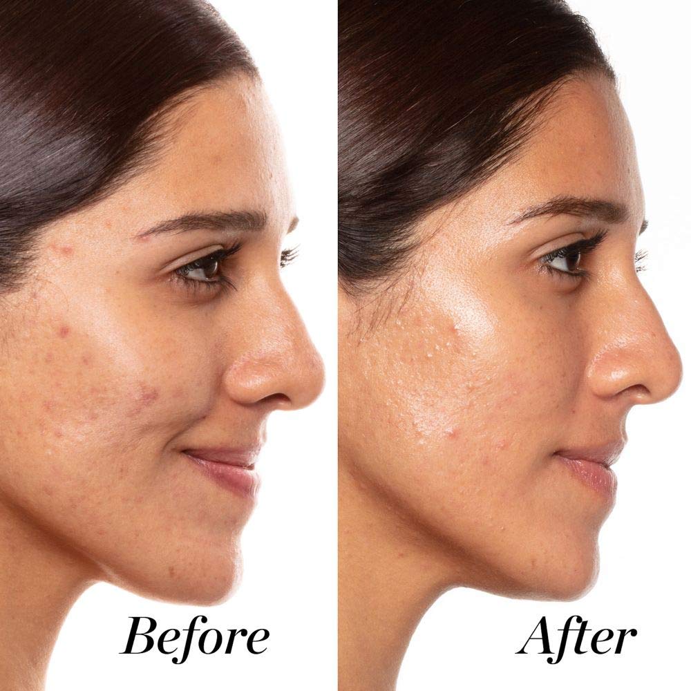 Serum chống lão hoá Sunday Riley A+ High Dose Retinoid Serum - hình ảnh chi tiết 5