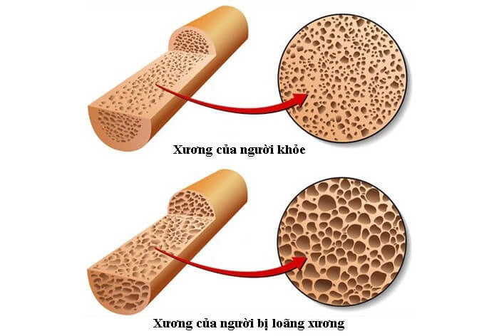 Viên uống Canxi Kirkland Calcium 600mg + D3 hộp 500 viên của Mỹ - ảnh sản phẩm 3